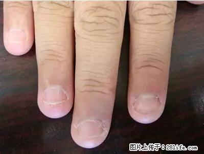剪指甲、挖耳屎，这些日常小动作竟隐藏大危害！ - 吕梁生活资讯 - 吕梁28生活网 lvliang.28life.net